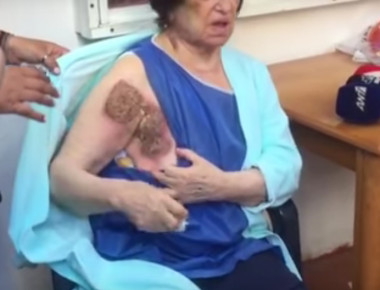 Συνελήφθη από την ΕΛ. ΑΣ. η αδίστακτη συμμορία των Γεωργιανών που «σιδέρωσαν» 85χρονη στην Κυψέλη (βίντεο)